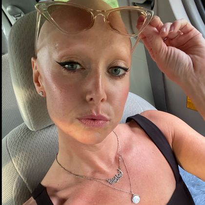 baldbikinibabe OnlyFans picture