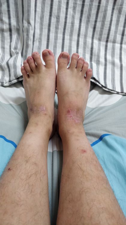 badscars OnlyFans picture
