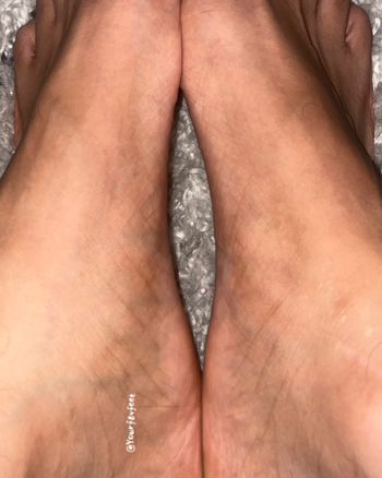10toesDown