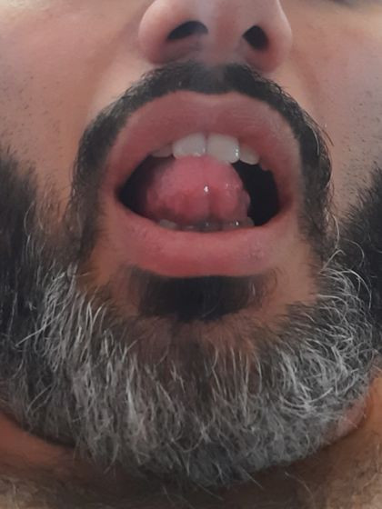 liukgt60773295 OnlyFans picture
