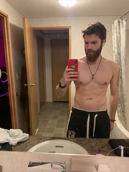 starvingpharming OnlyFans picture