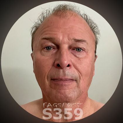 xbutzemann64 OnlyFans picture