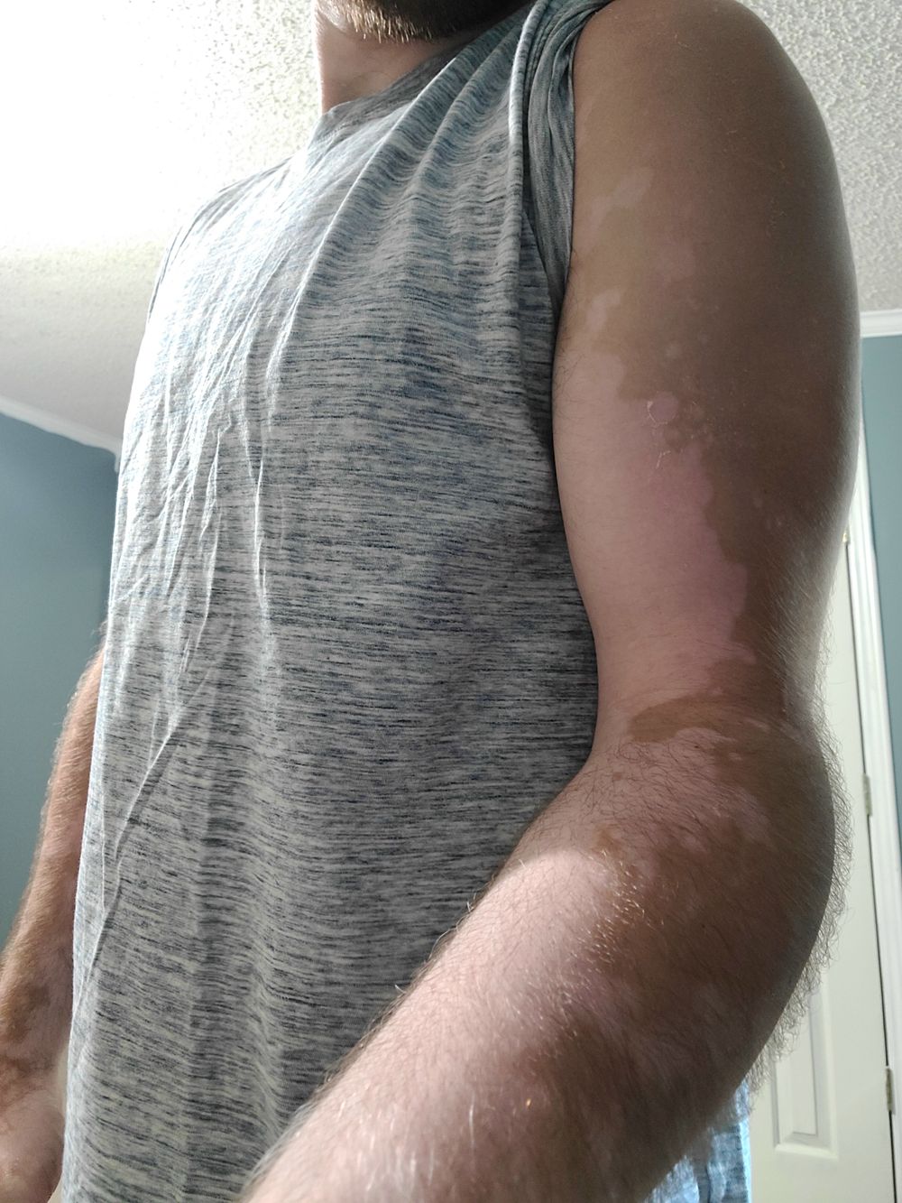 spottedgrower OnlyFans profile picture