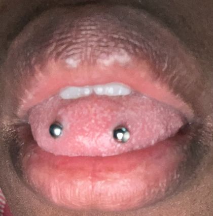 lipsntoes4daze OnlyFans picture