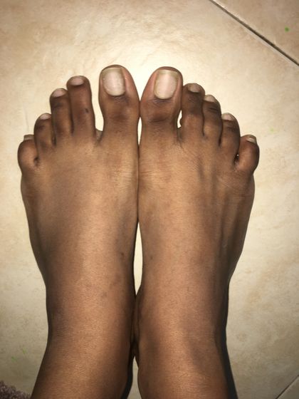 bareebonyfeet OnlyFans picture