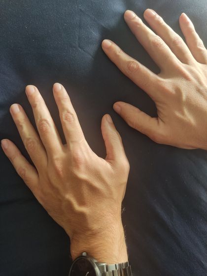 manhands_med OnlyFans picture
