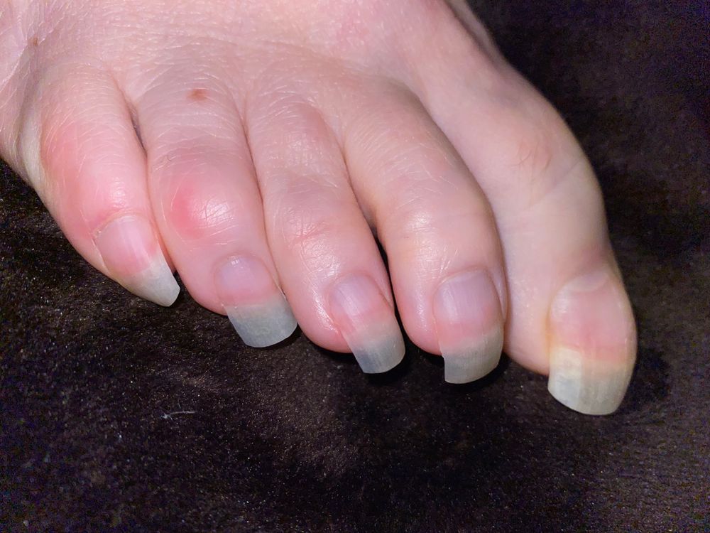 naturaltoesgirl OnlyFans profile picture
