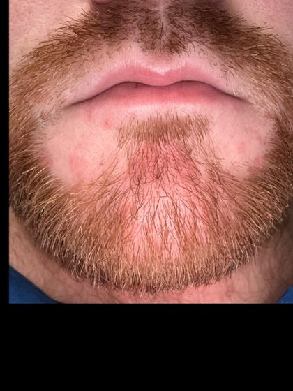 u106475521 OnlyFans picture