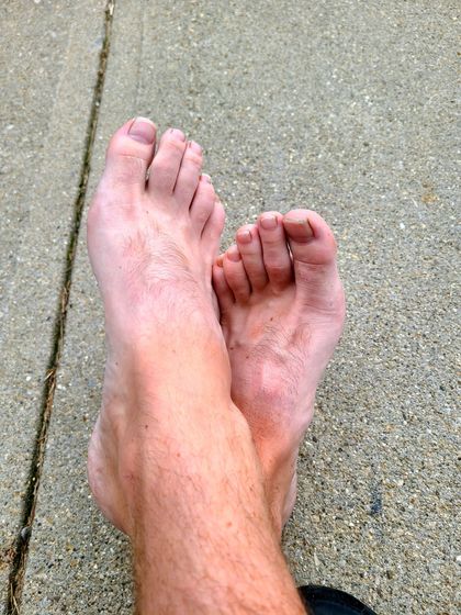 fozzyfirefeet OnlyFans picture