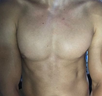 excito OnlyFans picture