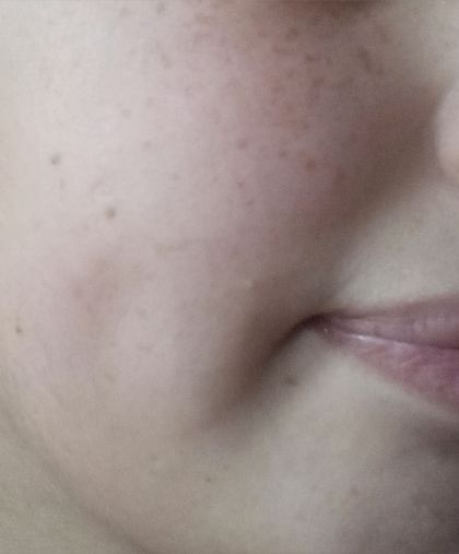 annelist4u OnlyFans picture