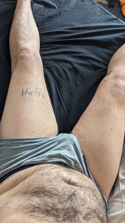 frogboiwithani OnlyFans picture