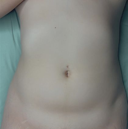 dabsbutton420 OnlyFans picture