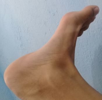 Júnior.