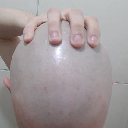 bald_slave OnlyFans picture