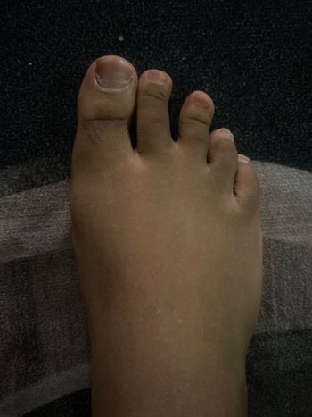 Footking