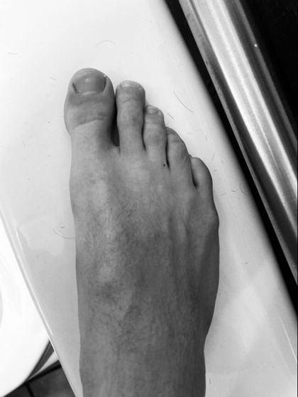 toenail_twink OnlyFans picture