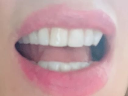 lippylips4 OnlyFans picture
