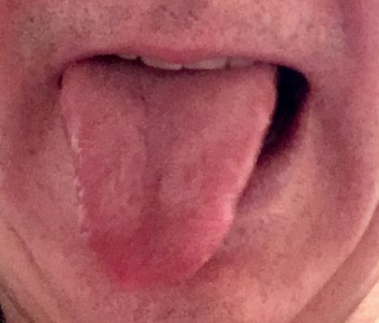 dutchboy2540 OnlyFans picture