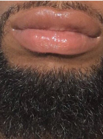 circoboylondon OnlyFans picture