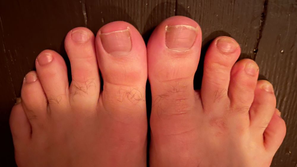 toesandthings4u OnlyFans profile picture