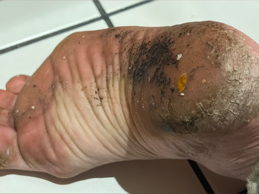 fckngdisgustingfeet OnlyFans profile picture