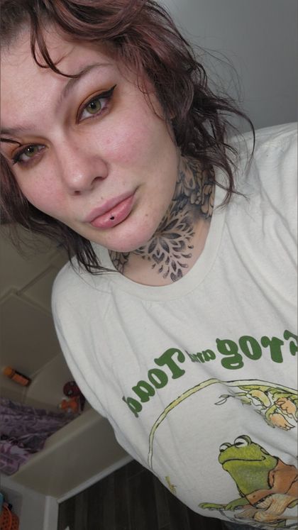bruisedforfun OnlyFans picture