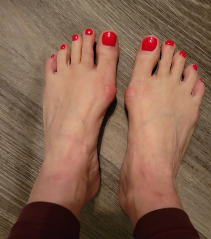 barefootbunionbabe OnlyFans picture