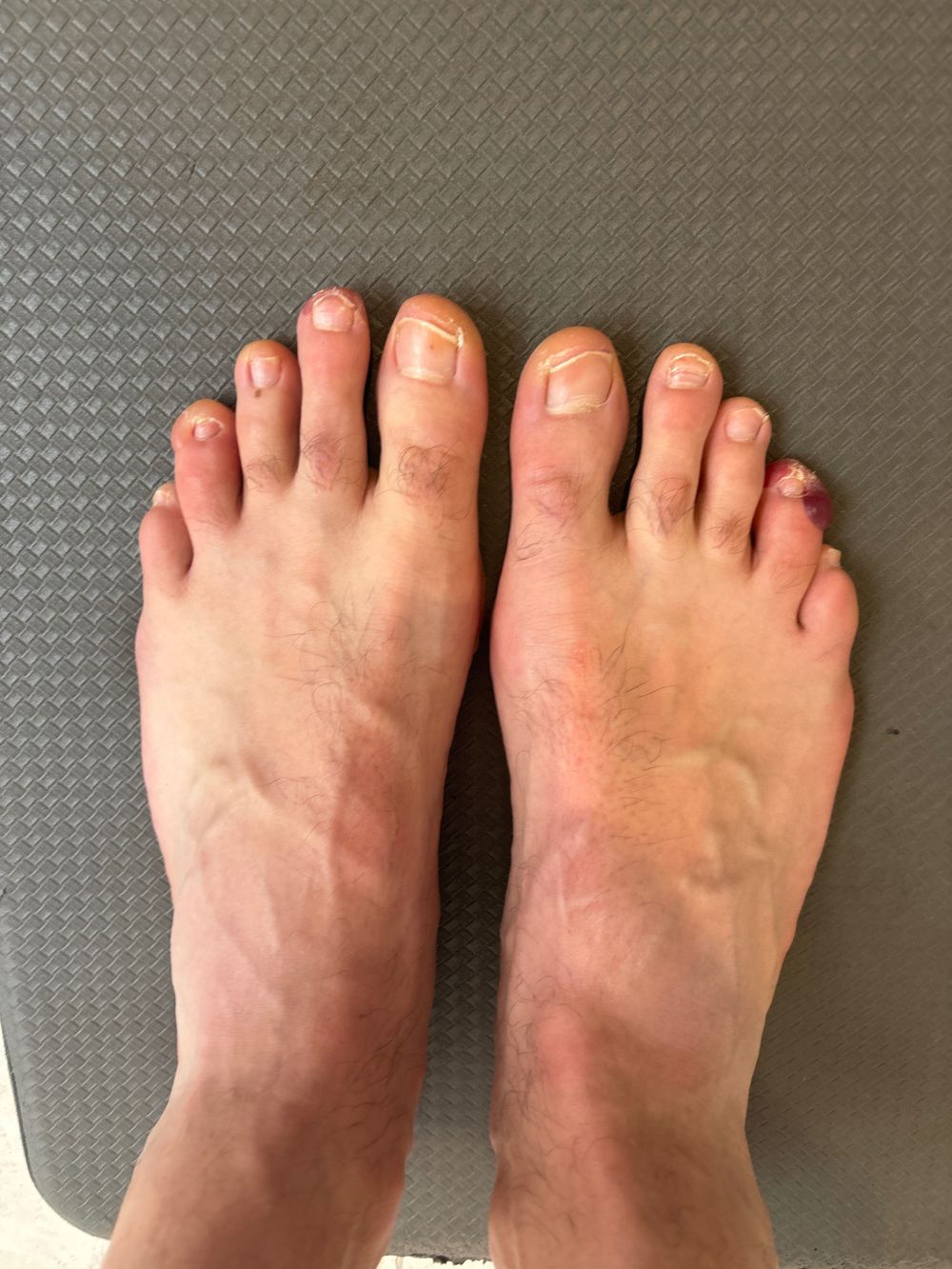 myuglyfeetaus OnlyFans profile picture