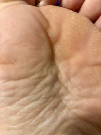 chubby feet
