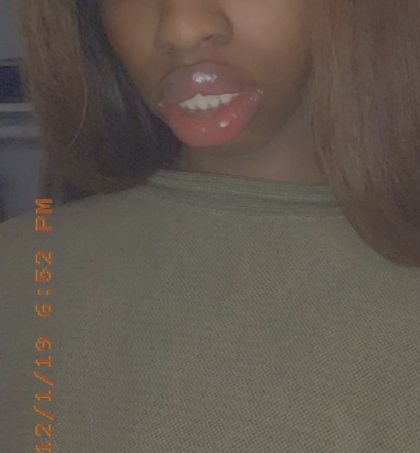 theelips OnlyFans picture