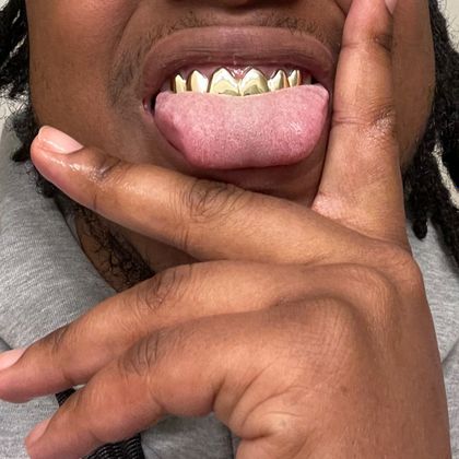tonytonichoppa OnlyFans picture