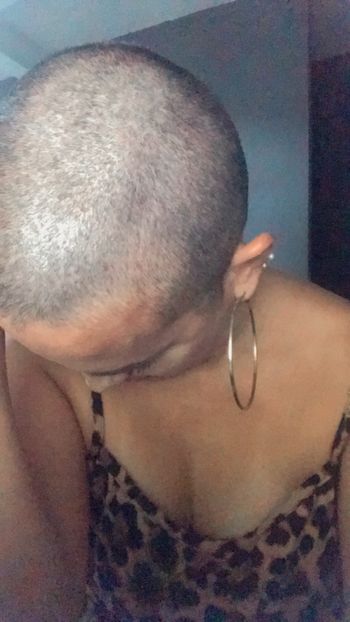 Bald Girl Br