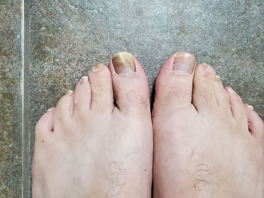 nastyfeet10 OnlyFans profile picture