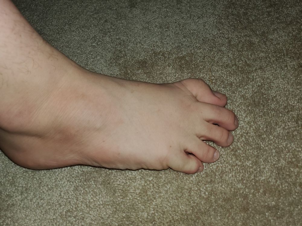 ictoesandfeet OnlyFans profile picture