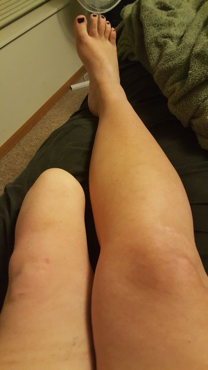 amputeeash OnlyFans picture
