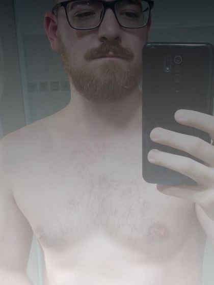opodoalpha OnlyFans picture