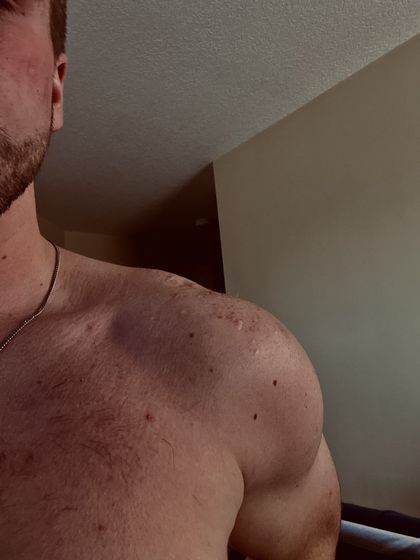 timskin OnlyFans picture